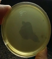 Archives of Clinical Infectious Diseases