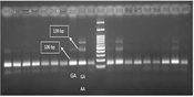 Jundishapur J Microbiol