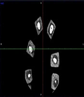 Iranian Journal of Radiology