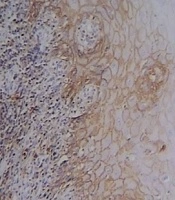 International Journal of Cancer Management