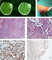 Iranian Journal of Pediatrics