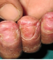 J Skin Stem Cell