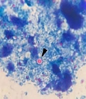 Jundishapur Journal of Microbiology