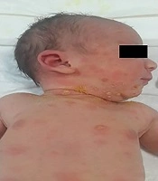 Archives of Pediatric Infectious Diseases