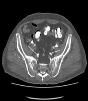 Iranian Journal of Radiology