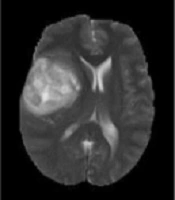  Archives of Neuroscience