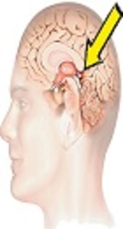 Papillary Tumor of the Pineal Region: Clinical Presentations, Prognostic Factors, Treatments, and Outcomes