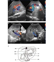 Iranian Journal of Radiology
