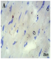 Int J Endocrinol Metab