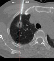 Iranian Journal of Radiology