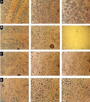 Jundishapur J Nat Pharm Prod