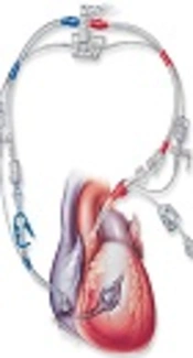 https://www.edwards.com/eu/products/cardiac/Pages/cardioplegiaimage2.aspx
