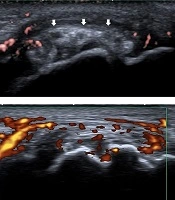Iranian Journal of Radiology