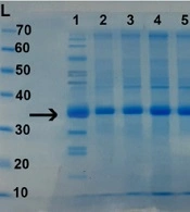 Jundishapur J Microbiol