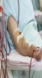Hemodialysis Adequacy Sacrificed for Business: A Qualitative Study
