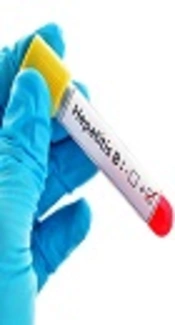 The Relationship Between 25-Hydroxyvitamin D<sub>3</sub> and Hepatitis B Surface Antigen Levels in Patients with Chronic Hepatitis B in Japan