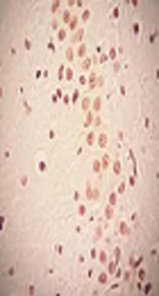 Vitamin E as an Antioxidant Reduces Apoptosis of Cells in Rat Hippocampus Following Exposure to Polyvinyl Chloride