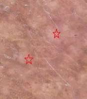 J Skin Stem Cell