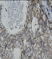 International Journal of Cancer Management