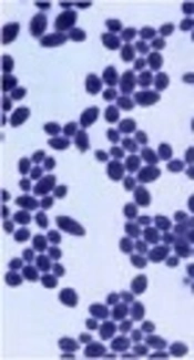 The Relative Frequency and Susceptibility Patterns of <i>Candida</i> Species Isolated from Blood and Urine of Children with Malignancy