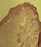 Jundishapur Journal of Microbiology 