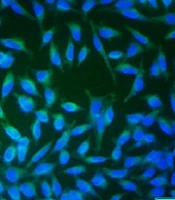Jentashapir J Cell Mol Biol
