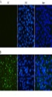 Western Blot analysis