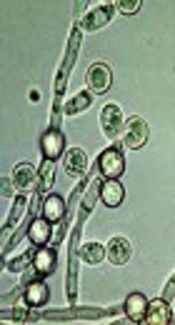https://www.shiftfrequency.com/michael-edwards-candida-albicans-the-foundation-of-illness/