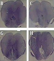 Arch Neurosci