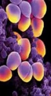 https://www.google.com/search?q=staphylococcus+aureus&source=lnms&tbm=isch&sa=X&sqi=2&ved=0ahUKEwjl1-rfsaPdAhUEy1MKHSqRCwIQ_AUICigB&biw=1366&bih=631#imgrc=xmjpRJxzgXczKM: