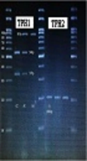 Association Study of TPH1 (rs1800532) and TPH2 (rs4570625) Polymorphisms in Type 1 Bipolar Disorder in Iran