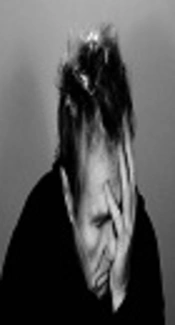 Pain and Sleep Measures in Methadone and in Suboxone Patients