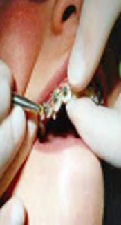 General Self-Efficacy and Self-Perceived Confidence of Dental Students in Performing Orthodontic Clinical Skills