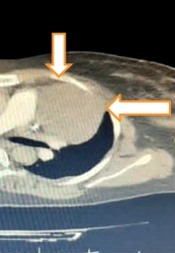 Fertility Gynecology Andrology