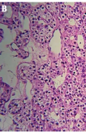 Int J Endocrinol Metab