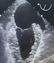 Multidiscip Cardio Annal