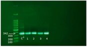 Jundishapur J Microbiol