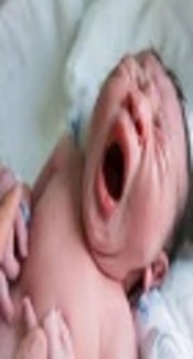 Investigating the Effect of Perineal Heating Pad on the Frequency of Episiotomies and Perineal Tears in Primiparous Females