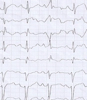 Multidiscip Cardio Annal