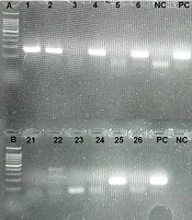 Jundishapur J Microbiol