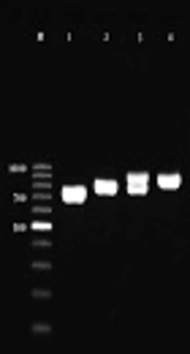 Molecular Identification of Clinically Common and Uncommon Yeast Species