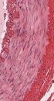 Contribution of Collagen Fibers to the Transmural Stress Distribution in Arterial Wall