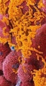 Study of Serologic Response Rate to <i>Haemophilus influenzae</i> Type B After Administration of the Third Dose of Pentavalent Vaccine in Children Aged 12 Months in Karaj City in 2016