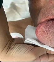 Int J High Risk Behav Addict