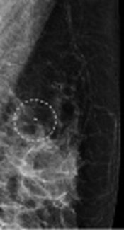 Iranian Journal of Radiology
