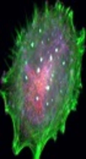 Different Concentrations of Titanium Dioxide Nanoparticles Induce Autophagy Followed by Growth Inhibition or Cell Death in A375 Melanoma Cells