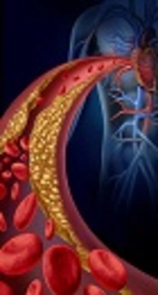 Serum Lipids During 20 Years in the Tehran Lipid and Glucose Study: Prevalence, Trends and Impact on Non-Communicable Diseases