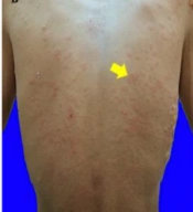 J Skin Stem Cell