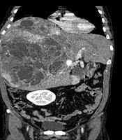 Iranian Journal of Radiology