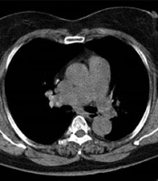 Iranian Journal of Radiology 